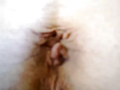 Bir cerrahla  seks genç güzel dudak enjeksiyonunu unutturur